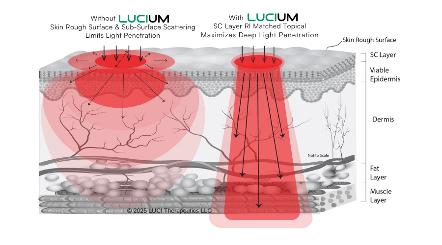 Without vs. With LUCIUM — optical clarification technology cross-section showing maximized deep light penetration